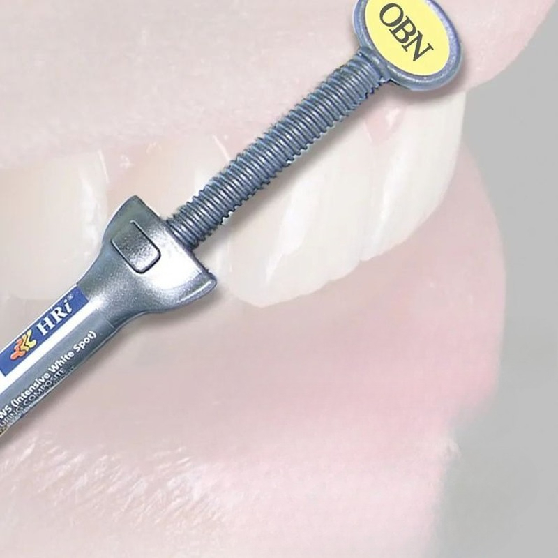 مواد طب الأسنان Meisu استعادة  - مراجعة Uv Resin وسعره